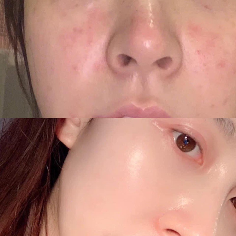 Collagen Bột lựu đẹp da | Thế Giới Skin Care