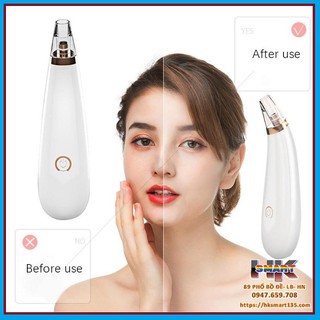 [Giasi261] MÁY HÚT MỤN CẦM TAY CAO CẤP
