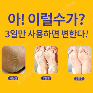 Tất gót chân, bảo vệ gót chân giảm viêm da,hạn chết nứt da gót chân