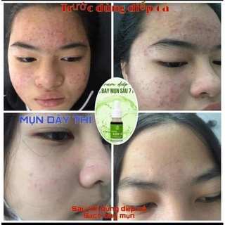 SỬA RỬA MẶT DIẾP CÁ