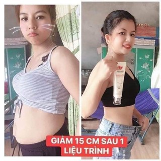 Giảm mỡ hiệu quả cùng kem tan mỡ Linh Hương (Sliming skin cream)