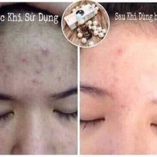Serum Dm beauty