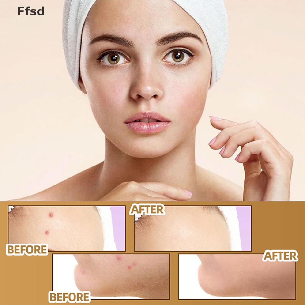 Bộ 60 Miếng Dán Che Khuyết Điểm Hình Xăm / Vết Sẹo / Vết Thâm Chống Thấm Nước