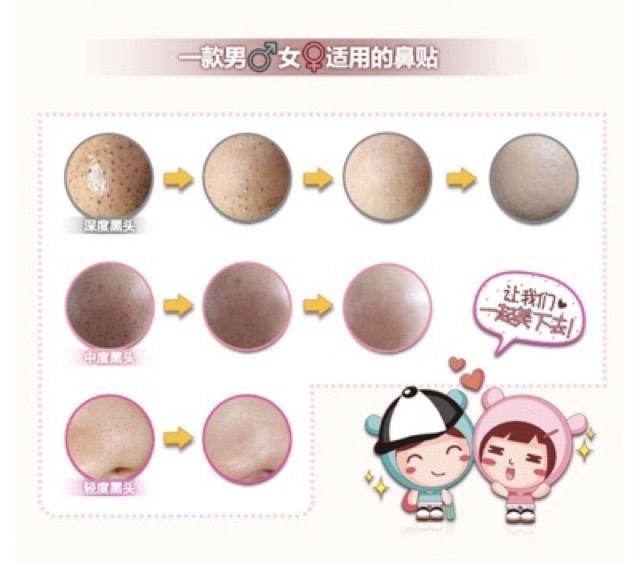 Set Lột mụn 3 miếng Bioaqua - Siêu Phẩm Lột Mụn Đầu Đen Mũi | BigBuy360 - bigbuy360.vn