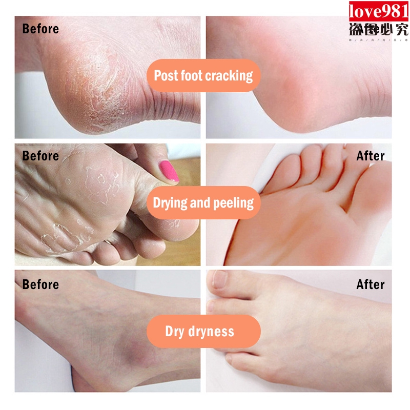 Kem dưỡng ẩm chống nứt nẻ tinh dầu chuối cao cấp | BigBuy360 - bigbuy360.vn