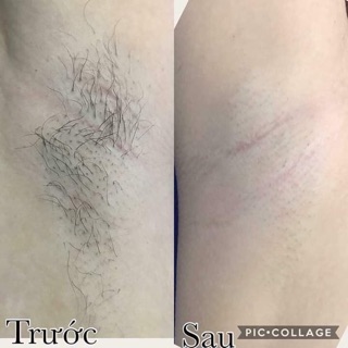 {SALE SHOCK} Siêu Tẩy Lông Thảo Dược D'Rose