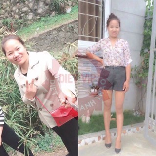 GIẢM CÂN DIET VIP( SET 5 VIÊN)