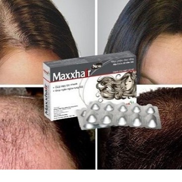 Viên uống Maxxhair - Hỗ trợ ngăn ngừa rụng tóc, kích thích mọc tóc nhanh (Hộp 30 viên)