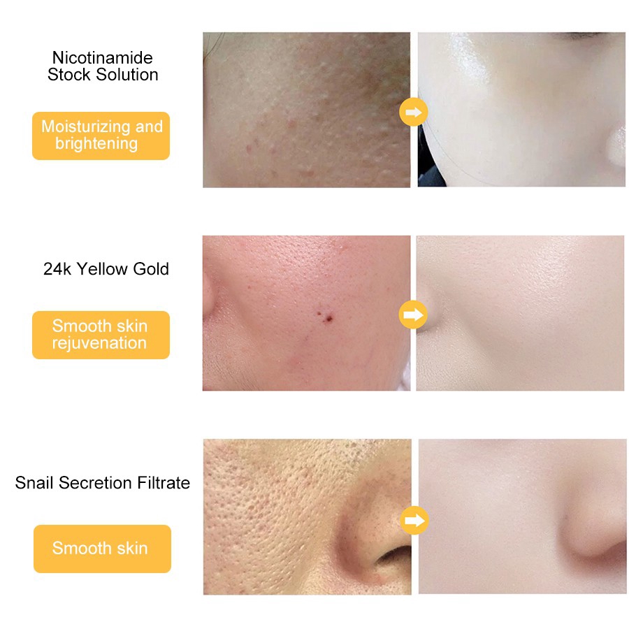 Serum chứa tinh chất lá vàng 24k và nicotinamide dưỡng ẩm cho da mặt se khít lỗ chân lông hiệu quả