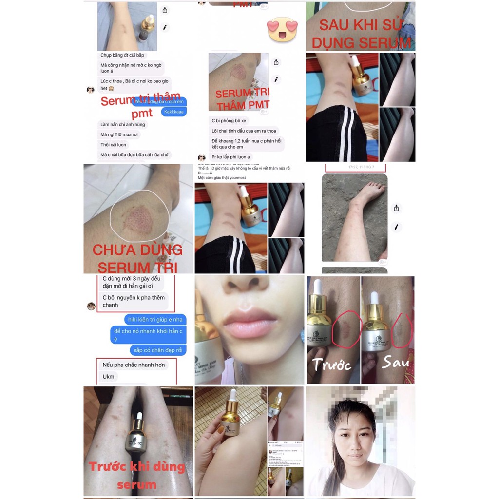 450K COM BO 2 CHAI SERUM MỜ THÂM ĐA NĂNG PHÚC MINH TÂM [Hàng Chính Hãng Được Bảo Hộ]