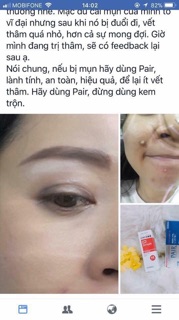 KEM TIÊU MỤN