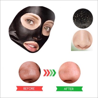 Mặt Nạ Thải Độc Tố