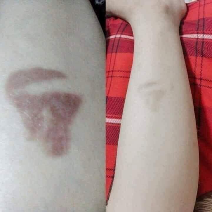 SERUM MỜ THÂM ĐA NĂNG PHÚC MINH TÂM [Hàng Chính Hãng Được Bảo Hộ] | Thế Giới Skin Care