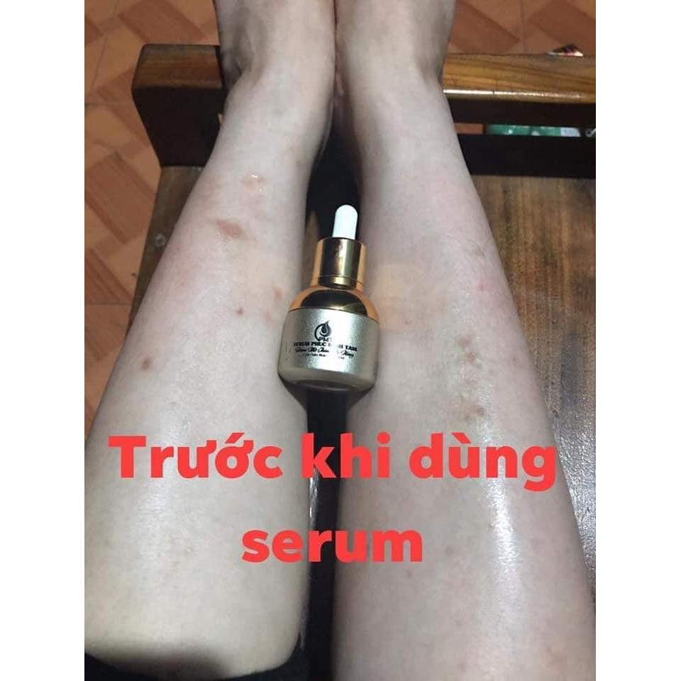 450K COM BO 2 CHAI SERUM MỜ THÂM ĐA NĂNG PHÚC MINH TÂM [Hàng Chính Hãng Được Bảo Hộ]