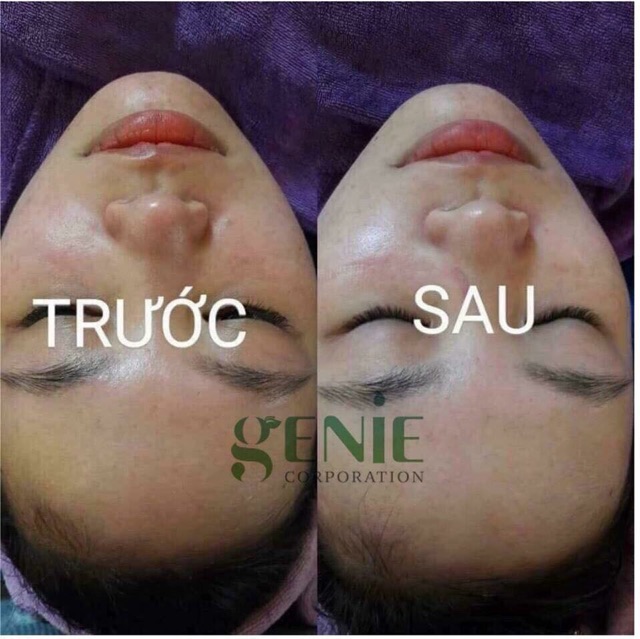 Ủ mặt nhau thai cừu trắng da genie hàn quốc | BigBuy360 - bigbuy360.vn