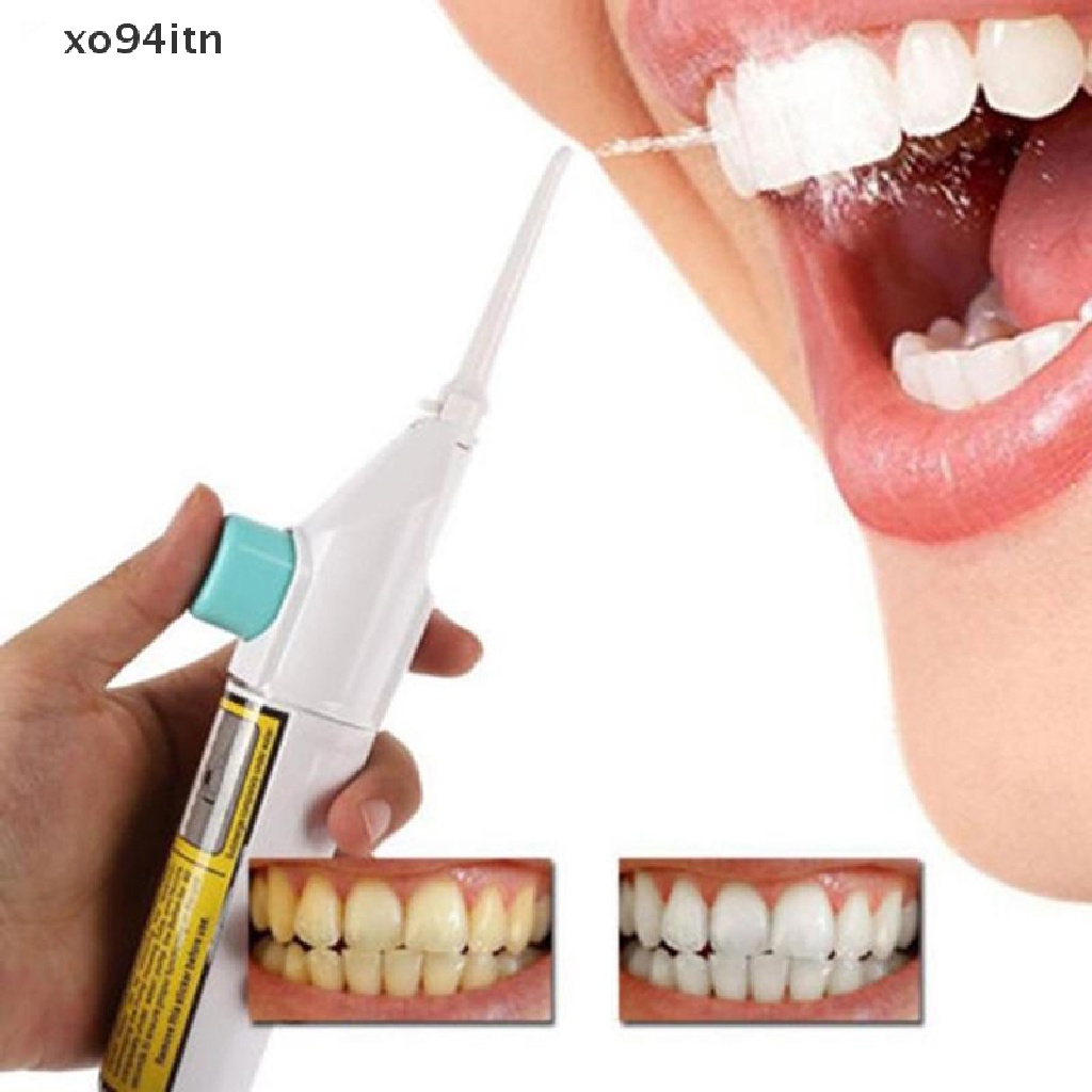 [Hàng mới về] Máy tăm nước làm sạch răng miệng nha khoa bằng khí chất lượng cao