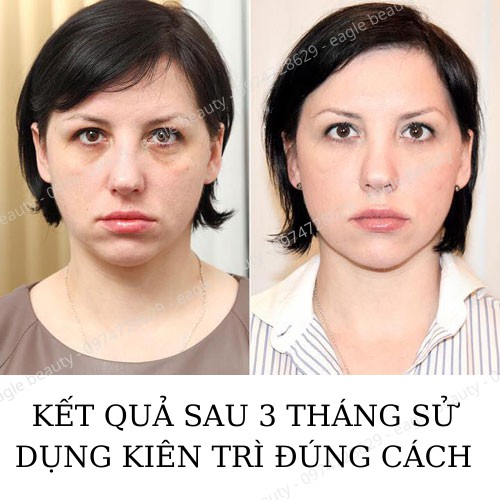 [MUA 2 TẶNG 1] Kem xóa Nếp Nhăn GOJI HENDEL’S làm trẻ hóa làn da,tăng sinh collagen - 100% chính hãng Nga