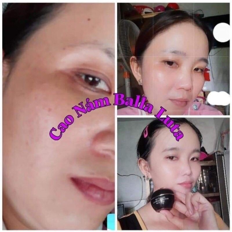 Cao Nám Balla Luta Hộp Lớn 30gr Chính Hãng Cty Thu Hằng
