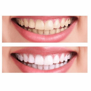 Kem Đánh Răng Crest 3D White Brilliance Toothpaste Mỹ