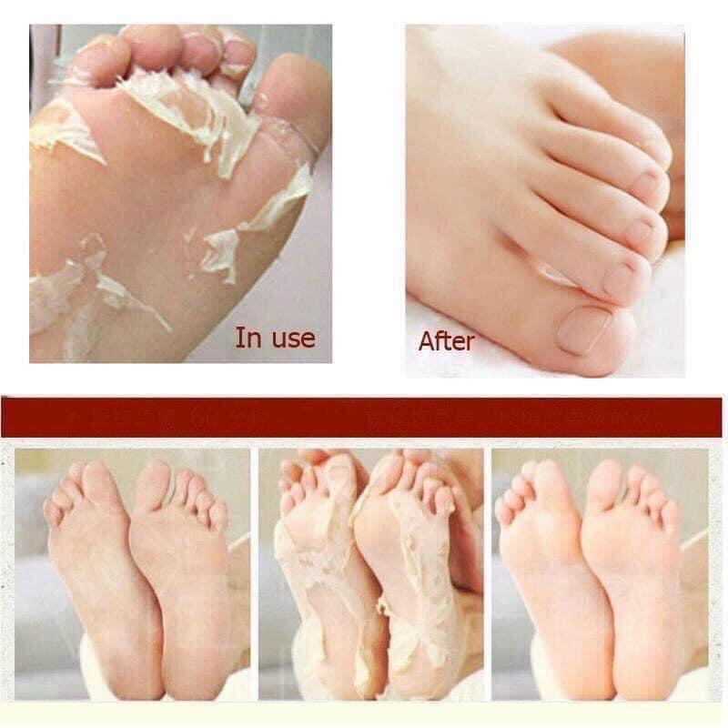 Túi Ủ Bong Da Chết Bàn Chân Mino Baby Foot Nhật Bản