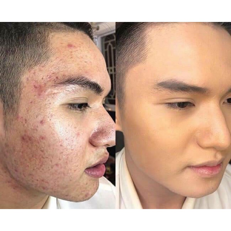 Combo giá sỉ 5 chai 450ml thảo dược nhân sâm tái tạo  handmade