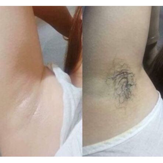 Kem Tẩy lông Kone Thái Lan Chính Hãng  An Toàn Hiệu quả | BigBuy360 - bigbuy360.vn