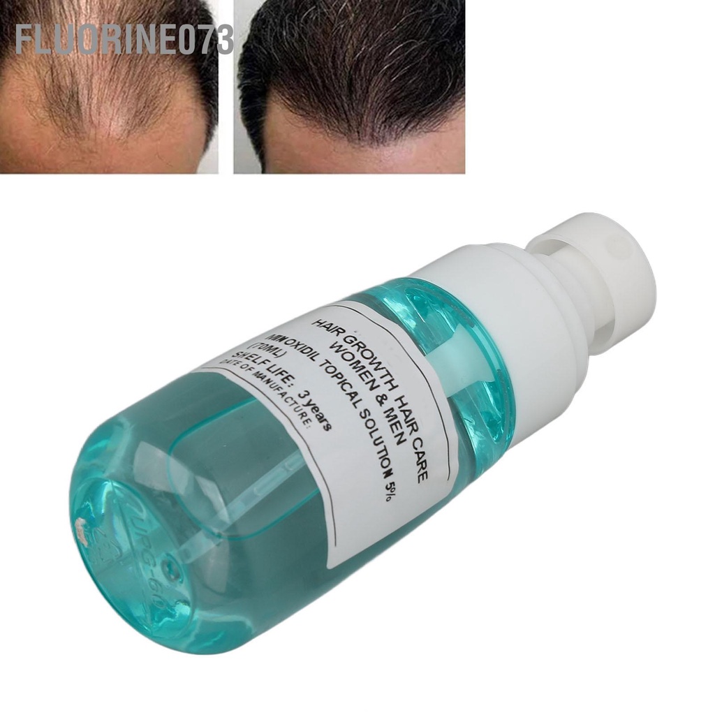 [Hàng Sẵn] 70ml Thuốc Xịt Mọc Tóc Nhanh Làm Dày Da Đầu Điều Trị Cho Nam Và Nữ 【Fluorine073】