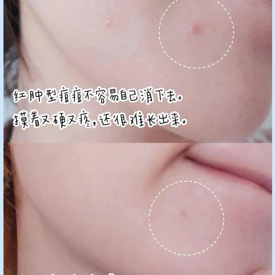 Gel Rửa Mặt tạo bọt La Roche-Posay Dành Cho Da Dầu, Nhạy Cảm