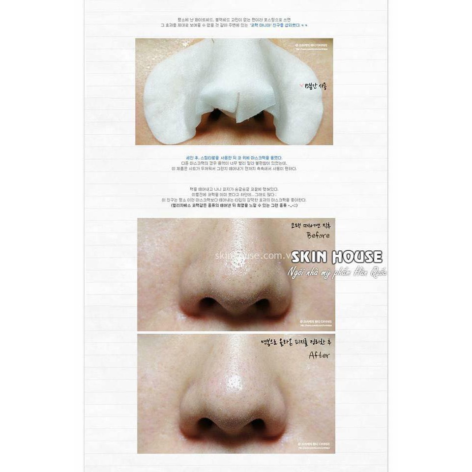 Mặt nạ serum đẩy mụn đầu đen Good-bye Blackhead Ciracle miếng lẻ