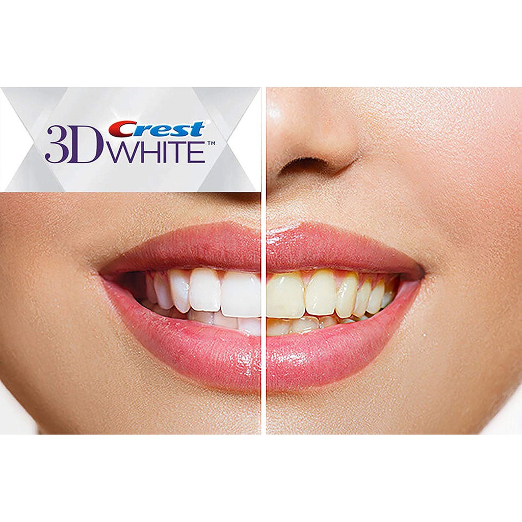 KEM ĐÁNH RĂNG CREST 3D WHITE ADVANCED 158Gr - MỸ.