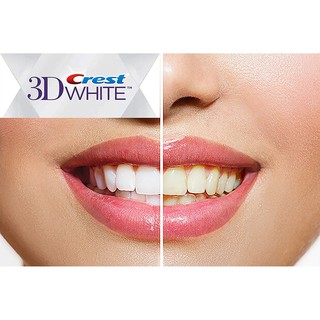 Kem đánh răng Crest 3D White làm trắng răng 158g