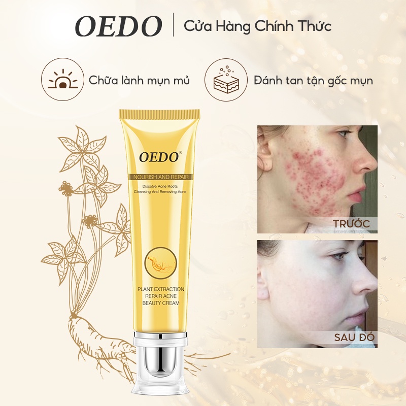 Kem phục hồi nhân sâm OEDO 20g