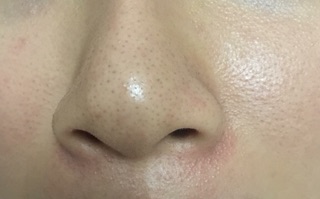 Mặt nạ lột mụn Good-bye Blackhead