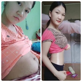 CAO TAN MỠ GỪNG NGHỆ