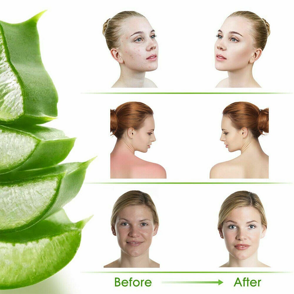 Gel nha đam tự nhiên 92% dưỡng ẩm chăm sóc da 220g