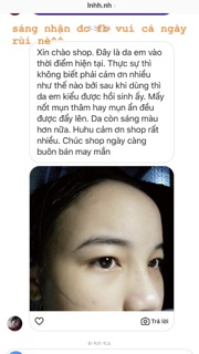 Combo Eye serum và serum mascara