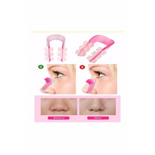 Dụng Cụ Kẹp Nâng Mũi