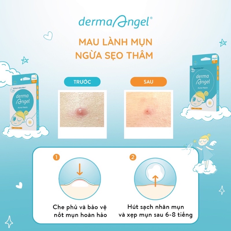 Bộ 3 Hộp Miếng Dán Mụn Ngày & Đêm Derma Angel Ance Patch 42 Miếng