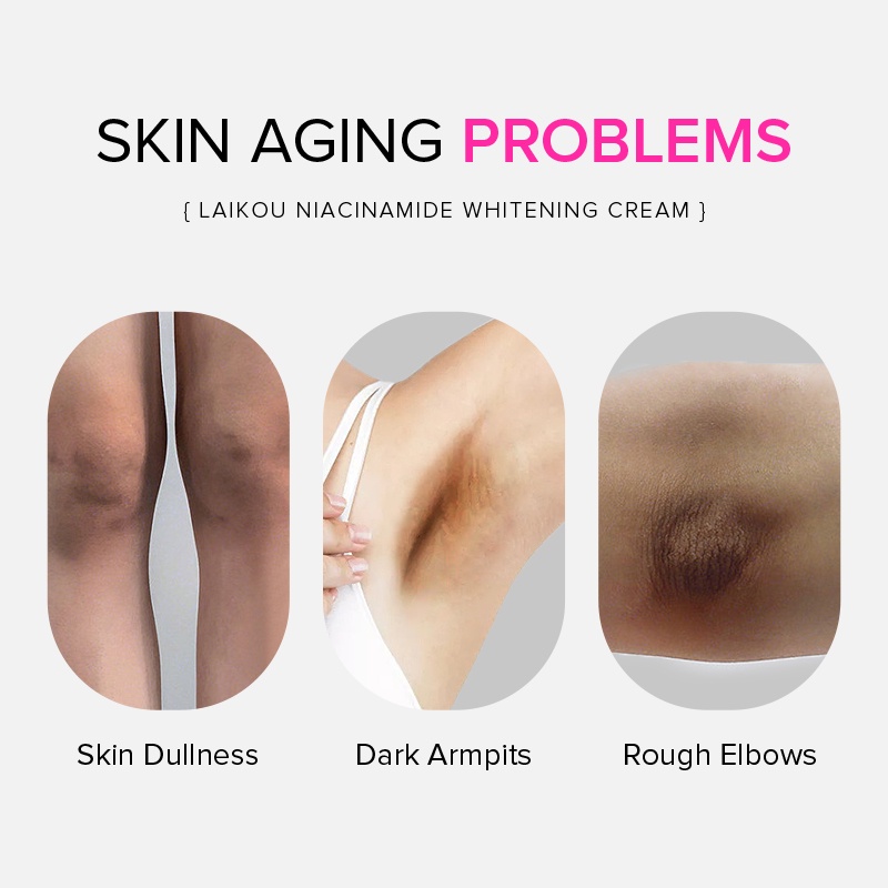 Kem dưỡng làm trắng vùng da dưới cánh tay Laikou giảm sắc tố cao 100g