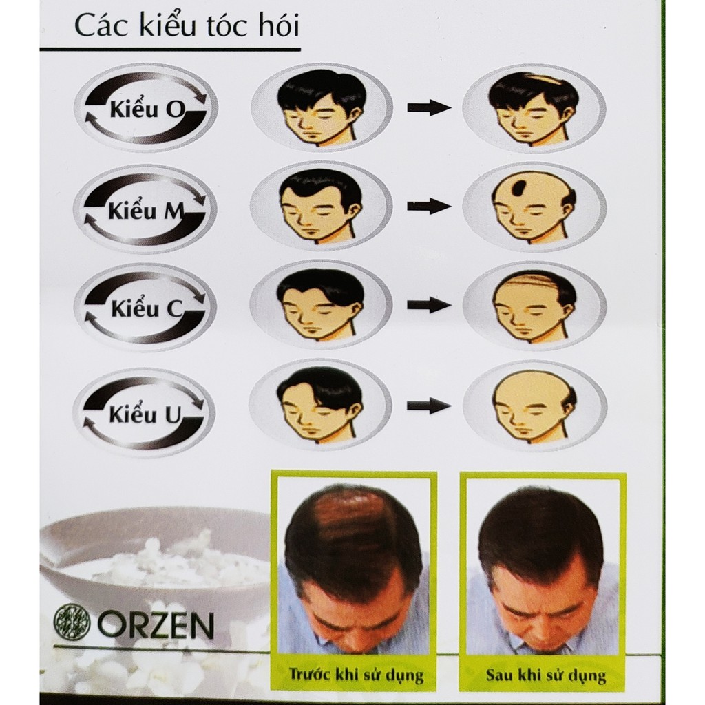 DẦU GỘI CHỐNG RỤNG TÓC ORZEN