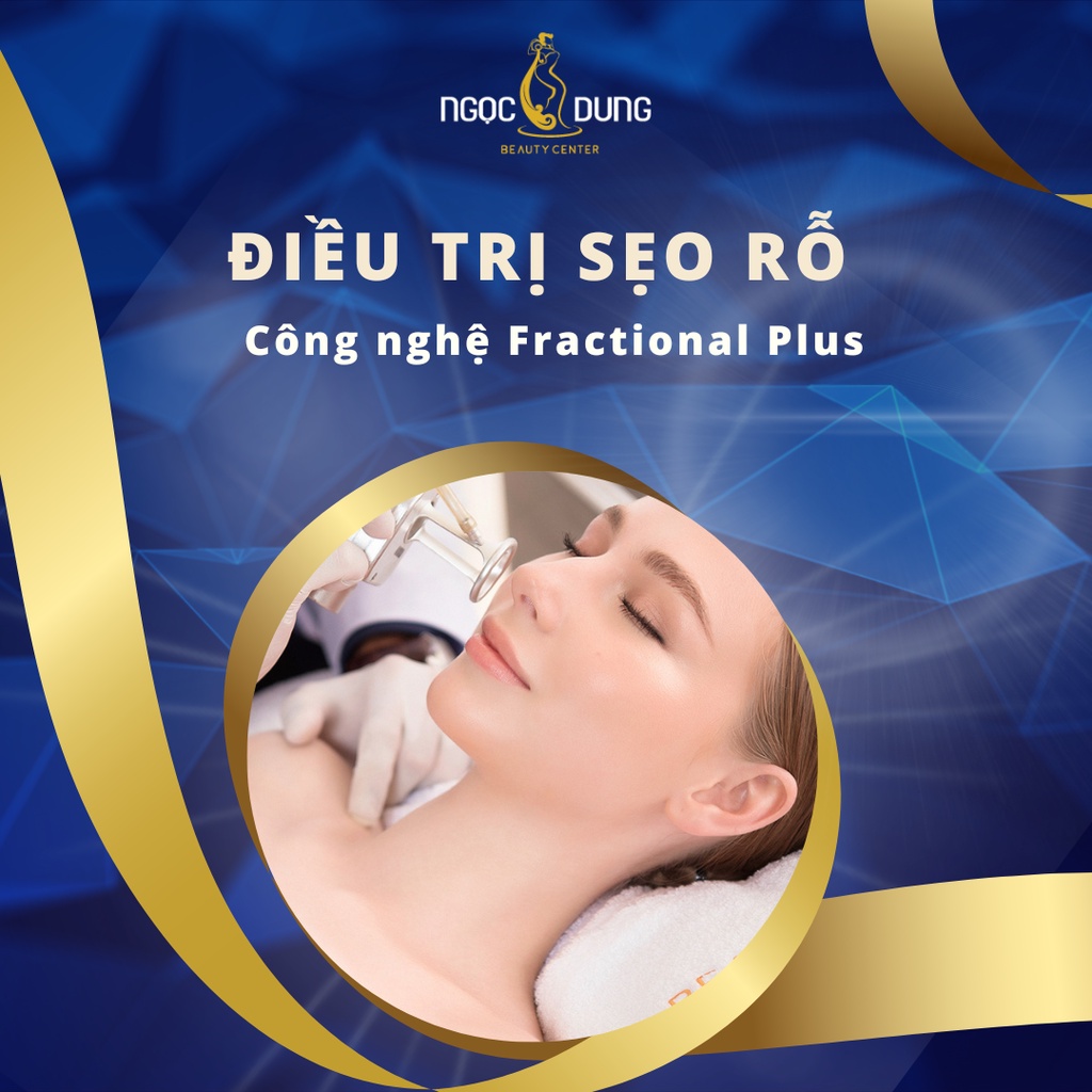 Giảm sẹo rỗ bằng Laser công nghệ cao Tại Thẩm Mỹ Viện Ngọc Dung