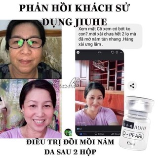 SERUM JIUHE THÂM BYE BYE MELANO