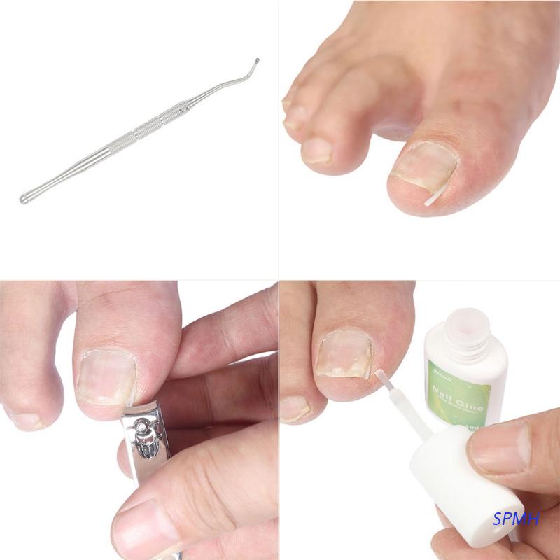 [Hàng mới về] 10 Dụng cụ chỉnh sửa móng chân mọc ngược tiện dụng