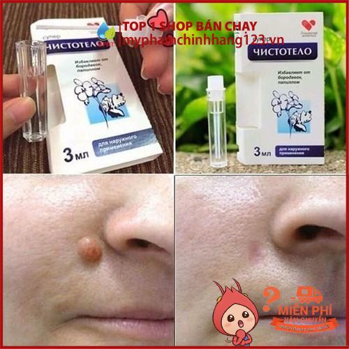 Gel tẩy nốt ruồi, mụn cóc, mụn thịt, tàn nhang, sẹo lồi Develinil chính hãng của Nga mới