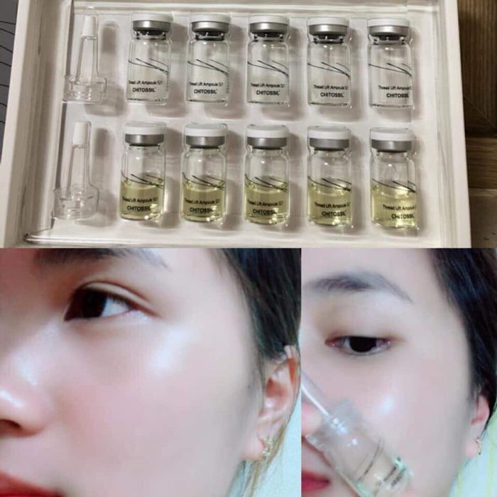 Chỉ tơ ằm chitossil hàng chính hãng | BigBuy360 - bigbuy360.vn