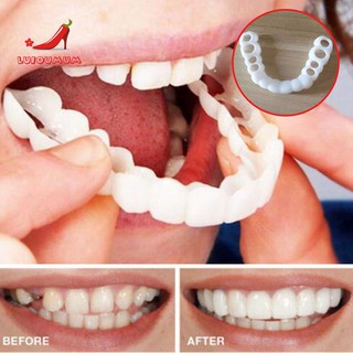Bọc răng chỉnh hình chuyên dụng cho nha khoa