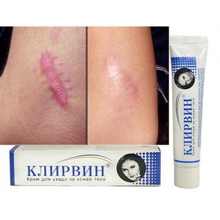 Kem trị sẹo Nga (Klirvin - Thần dược trị sẹo từ nước Nga)