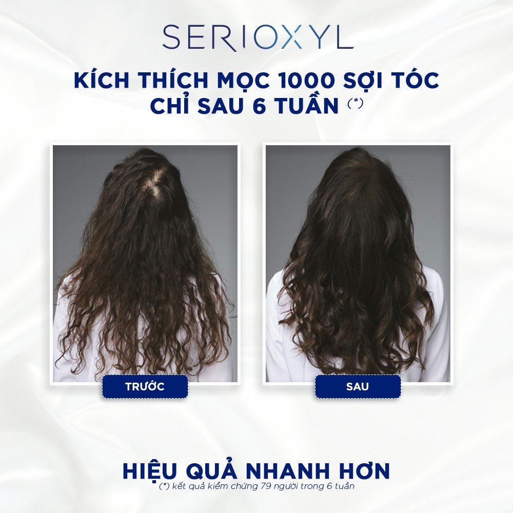 Combo gội xả giúp làm dày và kích thích mọc tóc L'Oréal Professionnel Serioxyl