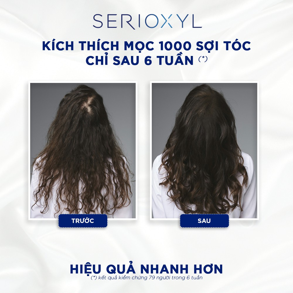 Dầu Gội Xả Làm Dày Tóc Chống Rụng Và Kích Thích Mọc Tóc - Serioxyl (Size Nhỏ) - Loreal Professionnel