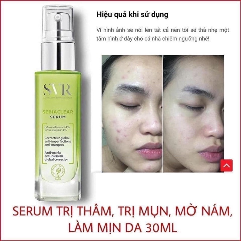 Mini size các dòng SVR 2ml,3ml,10ml